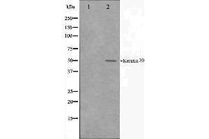 Western blot analysis on HeLa cell lysate using Keratin 20 Antibody. (KRT20 Antikörper  (C-Term))
