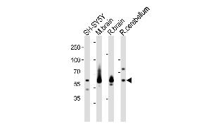 Western blot analysis of lysates from SH-SY5Y cell line, mouse brain, rat brain, rat cerebellum tissue (from left to right), using SYN1 Antibody (C-term) (ABIN1881860 and ABIN2843335). (SYN1 Antikörper  (C-Term))