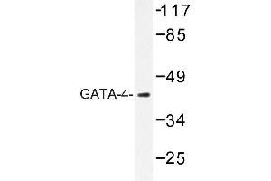 Image no. 2 for anti-GATA Binding Protein 4 (GATA4) antibody (ABIN272192) (GATA4 Antikörper)