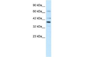 WB Suggested Anti-POU4F3 Antibody Titration:  1. (POU4F3 Antikörper  (Middle Region))