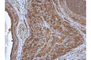 IHC-P Image HAX1 antibody detects HAX1 protein at cytoplasm in rat ovary by immunohistochemical analysis. (HAX1 Antikörper)