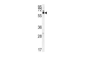 IKZF3 Antibody (Center) (ABIN651843 and ABIN2840420) western blot analysis in mouse liver tissue lysates (15 μg/lane). (IKZF3 Antikörper  (AA 76-103))