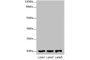 Western blot All lanes: FAIM antibody at 2 μg/mL Lane 1: 293T whole cell lysate Lane 2: Rat gonad tissue Lane 3: Jurkat whole cell lysate Secondary Goat polyclonal to rabbit IgG at 1/10000 dilution Predicted band size: 21, 25, 23 kDa Observed band size: 21 kDa (FAIM Antikörper  (AA 1-179))