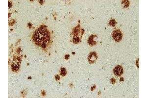 Immunostaining of paraffin embedded brain section from an Alzheimer´s patient (dilution 1 : 500). (Abeta 38/40/42 (AA 1-16), (AA 4-8) Antikörper)