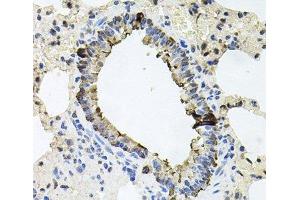 Immunohistochemistry of paraffin-embedded Rat lung using ERBB4 Polyclonal Antibody at dilution of 1:100 (40x lens). (ERBB4 Antikörper)