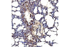 IHC analysis of Gephyrin/GPHN using anti-Gephyrin/GPHN antibody (ABIN7600086). (Gephyrin Antikörper  (AA 148-736))