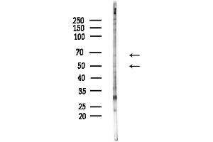 anti-Interferon Regulatory Factor 7 (IRF7) (pSer471), (pSer472) antibody