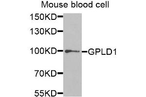Western blot analysis of extracts of mouse blood, using GPLD1 antibody (ABIN5973975) at 1/1000 dilution. (GPLD1 Antikörper)