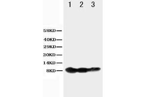 Anti-BAFF Receptor antibody, Western blotting Lane 1: Recombinant Human BAFFR Protein 10ng Lane 2: Recombinant Human BAFFR Protein 5ng Lane 3: Recombinant Human BAFFR Protein 2. (TNFRSF13C Antikörper  (N-Term))