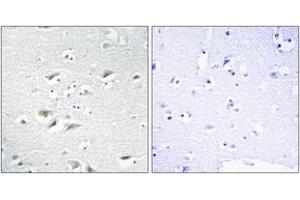 Immunohistochemistry analysis of paraffin-embedded human brain tissue, using ZEB2 Antibody.