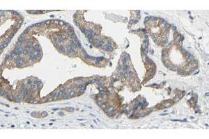 ABIN6269186 at 1/100 staining Human prostate tissue by IHC-P. (TNNI3 Antikörper  (N-Term))