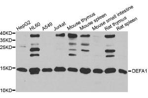 Western blot analysis of extracts of various cell lines, using DEFA1 antibody. (alpha Defensin 1 Antikörper  (AA 1-94))