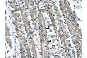 KIF5B antibody was used for immunohistochemistry at a concentration of 4-8 ug/ml to stain Skeletal muscle cells (lndicated with Arrows) in Human Muscle.