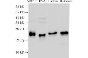 Western Blot analysis of NIH/3T3, K562 cells, Rat spleen and Rat stomach using CDK4 Polyclonal Antibody at dilution of 1:1000 (CDK4 Antikörper)