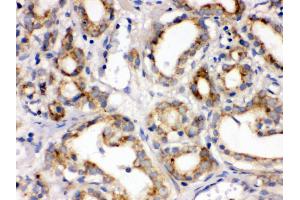 Immunohistochemistry (Paraffin-embedded Sections) (IHC (p)) image for anti-Frizzled Family Receptor 1 (Fzd1) (AA 369-400), (C-Term) antibody (ABIN3042412)
