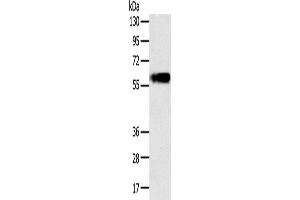 Western Blotting (WB) image for anti-Perilipin 1 (PLIN1) antibody (ABIN2435178)