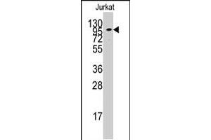 Western blot analysis of ADCY2 polyclonal antibody  in Jurkat cell line lysates (35 ug/lane). (ADCY2 Antikörper  (C-Term))