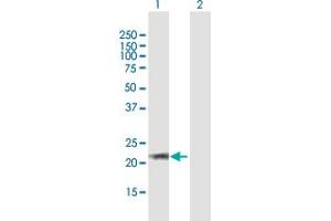 Western Blot analysis of ARL6 expression in transfected 293T cell line by ARL6 MaxPab polyclonal antibody. (ARL6 Antikörper  (AA 1-186))