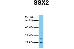 Host:  Rabbit  Target Name:  SSX2  Sample Tissue:  Human Jurkat  Antibody Dilution:  1.
