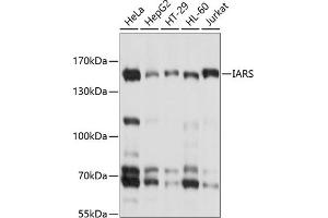 Western blot analysis of extracts of various cell lines, using IARS antibody (ABIN6132301, ABIN6142113, ABIN6142114 and ABIN6214344) at 1:1000 dilution. (IARS Antikörper  (AA 1158-1262))