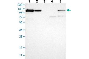 Western blot analysis of Lane 1: RT-4, Lane 2: U-251 MG, Lane 3: Human Plasma, Lane 4: Liver, Lane 5: Tonsil with NFKB2 polyclonal antibody  at 1:250-1:500 dilution. (NFKB2 Antikörper)