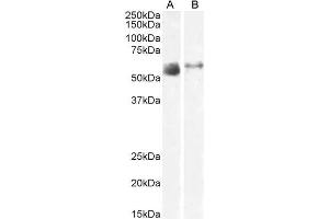 ABIN6391414 (2µg/ml) staining of Human Lung (A) and Skeletal Muscle (B) lysate (35µg protein in RIPA buffer). (SLC7A7 Antikörper  (N-Term))