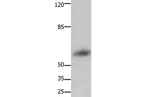 Western Blot analysis of Human liver cancer tissue using FOXJ3 Polyclonal Antibody at dilution of 1:800 (FOXJ3 Antikörper)