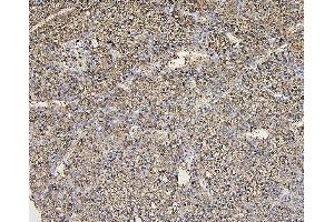 IHC analysis of ALDOB using anti-ALDOB antibody (ABIN7602563).