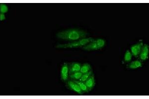 Immunofluorescent analysis of HepG2 cells using ABIN7167799 at dilution of 1:100 and Alexa Fluor 488-congugated AffiniPure Goat Anti-Rabbit IgG(H+L) (Retinoic Acid Receptor beta Antikörper  (AA 1-85))