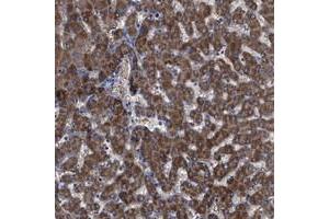 Immunohistochemical staining of human liver with GPR179 polyclonal antibody  shows distinct cytoplasmic positivity in hepatocytes at 1:200-1:500 dilution.