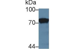 Detection of F1+2 in Rat Kidney lysate using Polyclonal Antibody to Prothrombin Fragment 1+2 (F1+2) (Prothrombin Fragment 1+2 Antikörper  (AA 44-323))