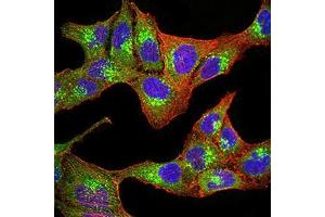 Immunocytochemistry (ICC) image for anti-Progesterone Receptor Membrane Component 1 (PGRMC1) (AA 1-195) antibody (ABIN5873919) (PGRMC1 Antikörper  (AA 1-195))