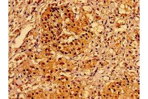 Immunohistochemistry of paraffin-embedded human adrenal gland tissue using ABIN7143732 at dilution of 1:100 (AAGAB Antikörper  (AA 191-315))