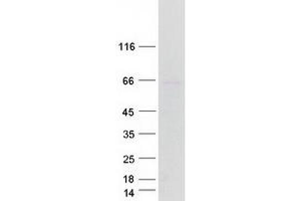 Arylsulfatase D Protein (ARSD) (Transcript Variant 1) (Myc-DYKDDDDK Tag)