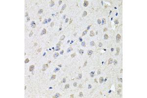 Immunohistochemistry of paraffin-embedded mouse brain using CHCHD3 antibody (ABIN5995784) at dilution of 1/100 (40x lens). (CHCHD3 Antikörper)