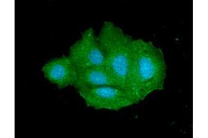ICC/IF analysis of SULT2A1 in Hep3B The cell was stained with ATGA0491 (1:100).