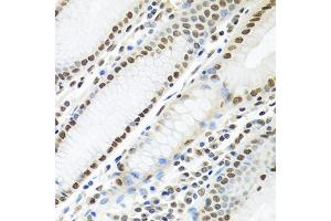 Immunohistochemistry of paraffin-embedded human stomach using PTBP1 antibody (ABIN5995415) at dilution of 1/100 (40x lens). (PTBP1 Antikörper)