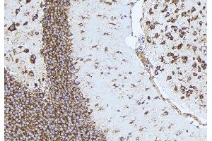 ABIN6277161 at 1/100 staining Mouse brain tissue by IHC-P. (NPPB Antikörper  (Internal Region))