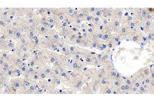 Detection of FGF23 in Human Liver Tissue using Polyclonal Antibody to Fibroblast Growth Factor 23 (FGF23) (FGF23 Antikörper  (AA 79-160))