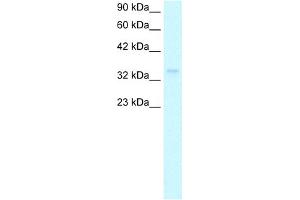 WB Suggested Anti-NPM1 Antibody Titration:  1. (NPM1 Antikörper  (Middle Region))