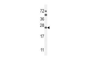 SCN1B Antikörper  (N-Term)