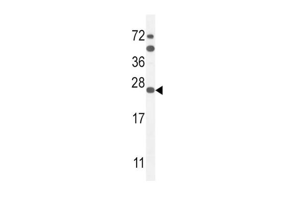 SCN1B Antikörper  (N-Term)