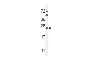 SCN1B Antibody (N-Term) (ABIN654602 and ABIN2844301) western blot analysis in mouse Neuro-2a cell line lysates (35 μg/lane). (SCN1B Antikörper  (N-Term))