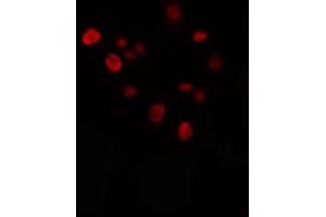 ABIN6274336 staining Hela cells by IF/ICC. (KLF Antikörper)