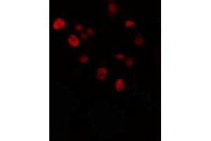ABIN6274336 staining Hela cells by IF/ICC.