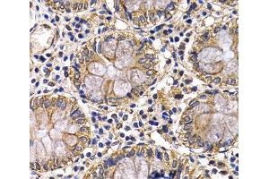 Immunohistochemistry of paraffin-embedded Human colon using ARRB2 Polyclonal Antibody at dilution of 1:200 (40x lens). (Arrestin 3 Antikörper)