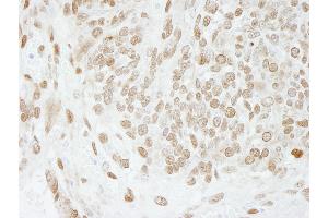 Immunohistochemistry (IHC) image for anti-Activated RNA Polymerase II Transcriptional Coactivator p15 (SUB1) (AA 77-127) antibody (ABIN7448719)