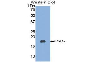 Western blot analysis of the recombinant protein. (Adamts2 Antikörper  (AA 474-610))
