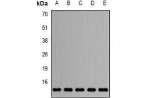 Western blot analysis of Sm-D2 expression in HepG2 (A), Jurkat (B), mouse testis (C), mouse heart (D), rat brain (E) whole cell lysates. (SNRPD2 Antikörper)