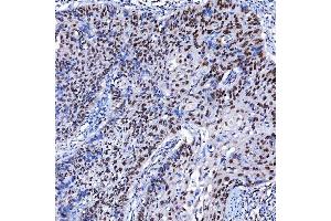 IHC analysis of SF3A1 using anti-SF3A1 antibody (ABIN7600556). (SF3A1 Antikörper  (AA 20-556))